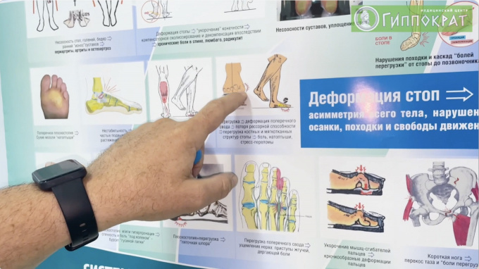 Закажите в медицинском центре «Гиппократ» стельки, которые лечат!